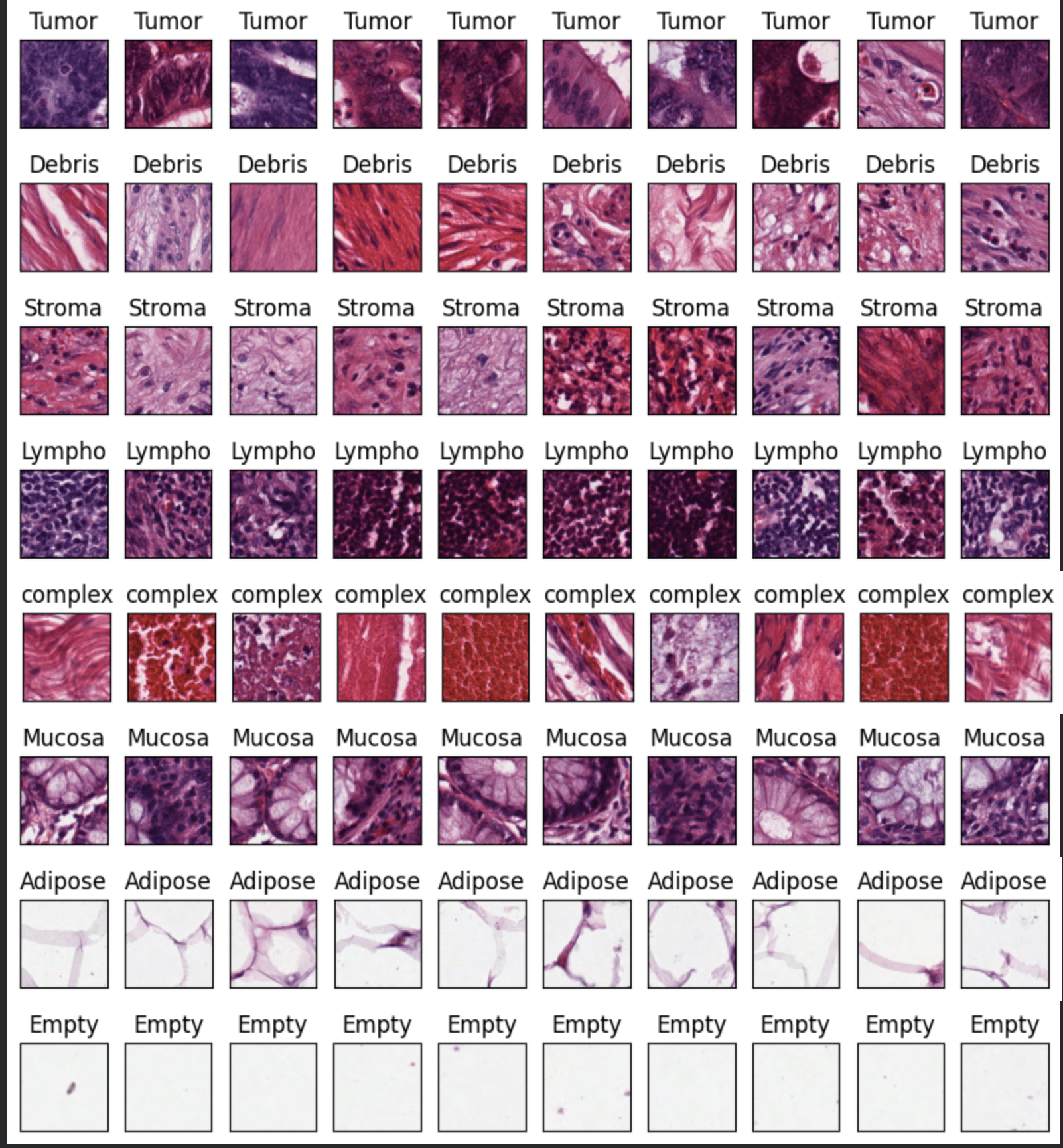 Grid of sample histopathology images from all eight tissue classes: tumour, debris, stroma, lymphocytes, complex, mucosa, adipose, and empty