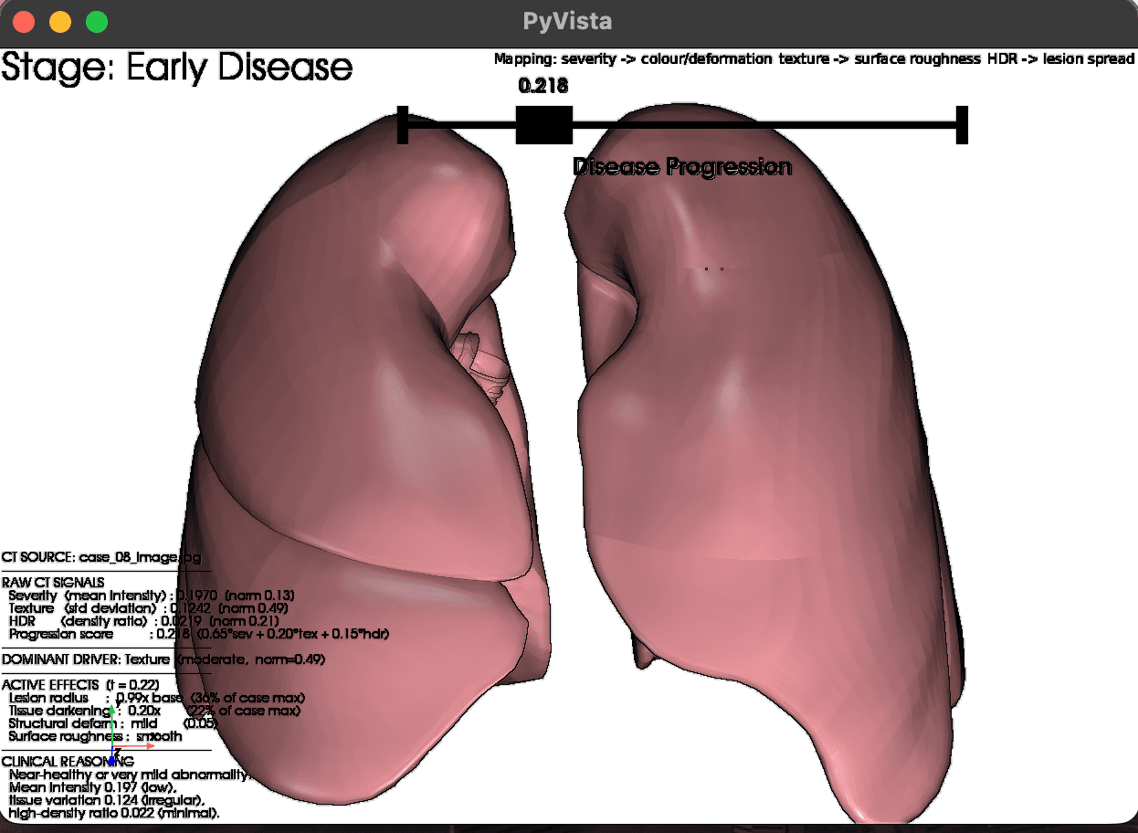 3D lung render for Case 08, progression score 0.218, light pink and smooth